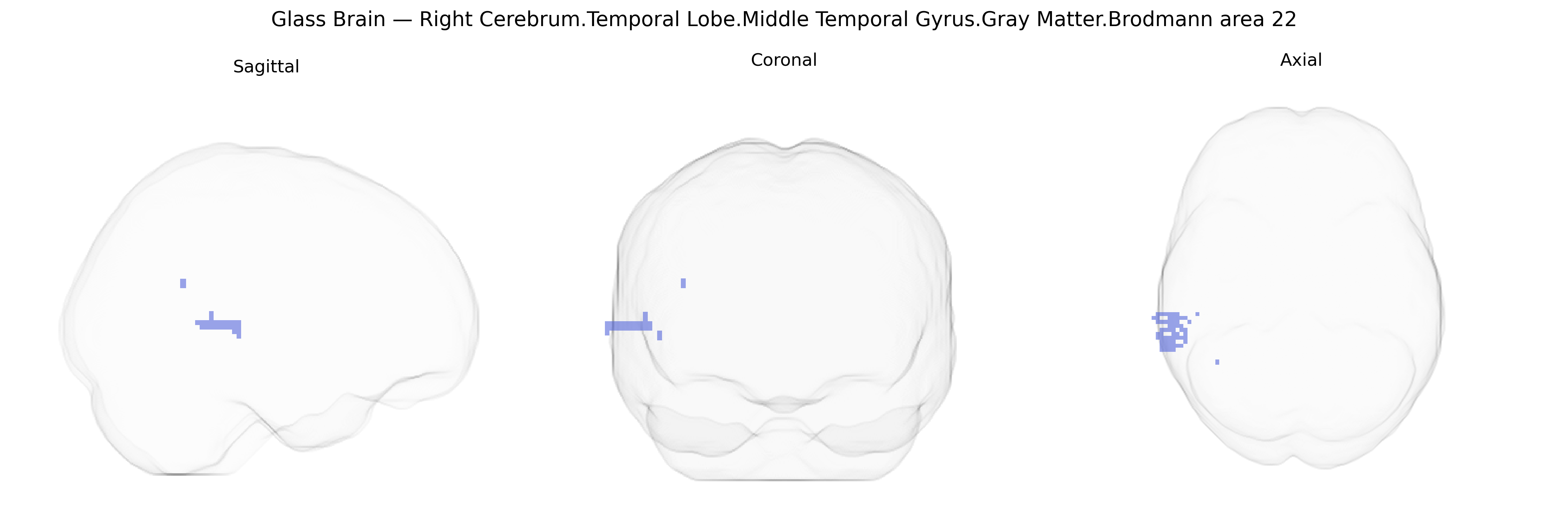 Triplanar Ghost Brain