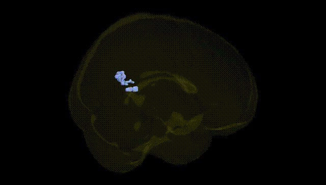 Full Brain Black