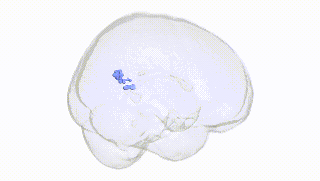 Full Brain White