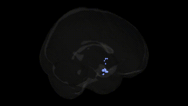 Full Brain Black