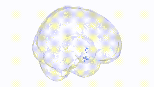 Full Brain White