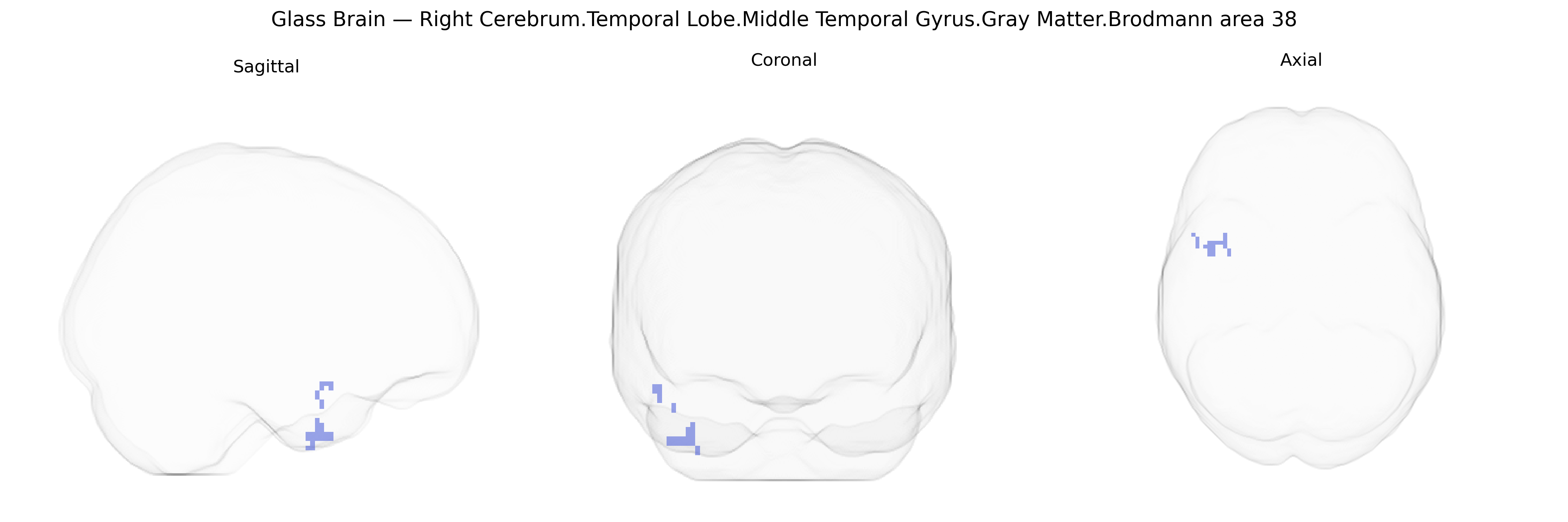 Triplanar Ghost Brain