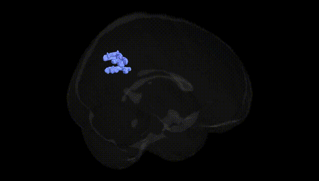 Full Brain Black