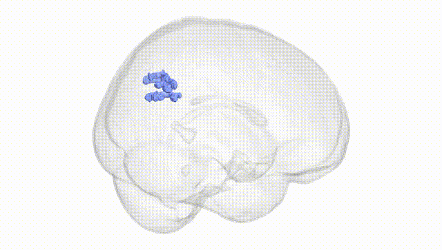 Full Brain White