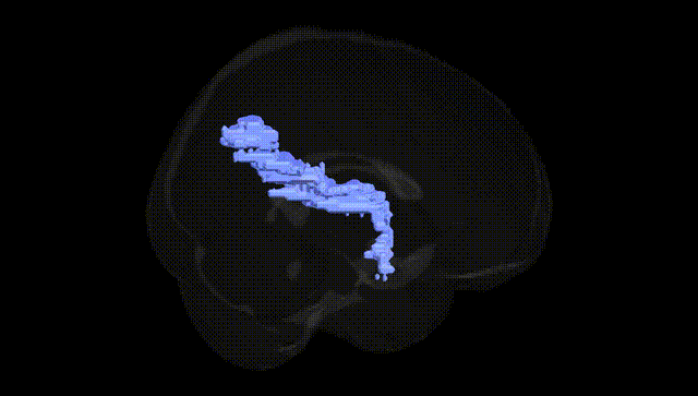 Full Brain Black