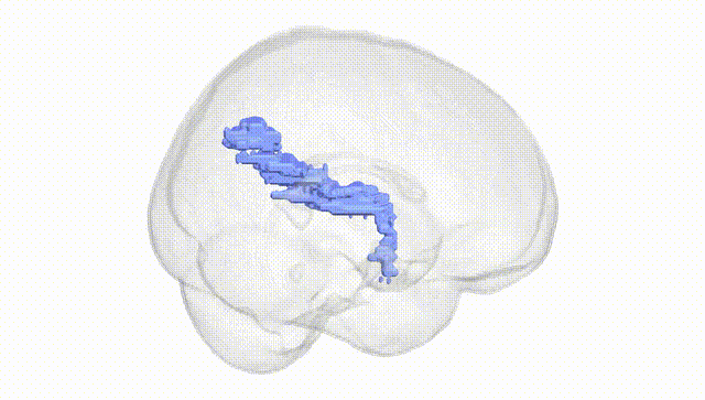 Full Brain White