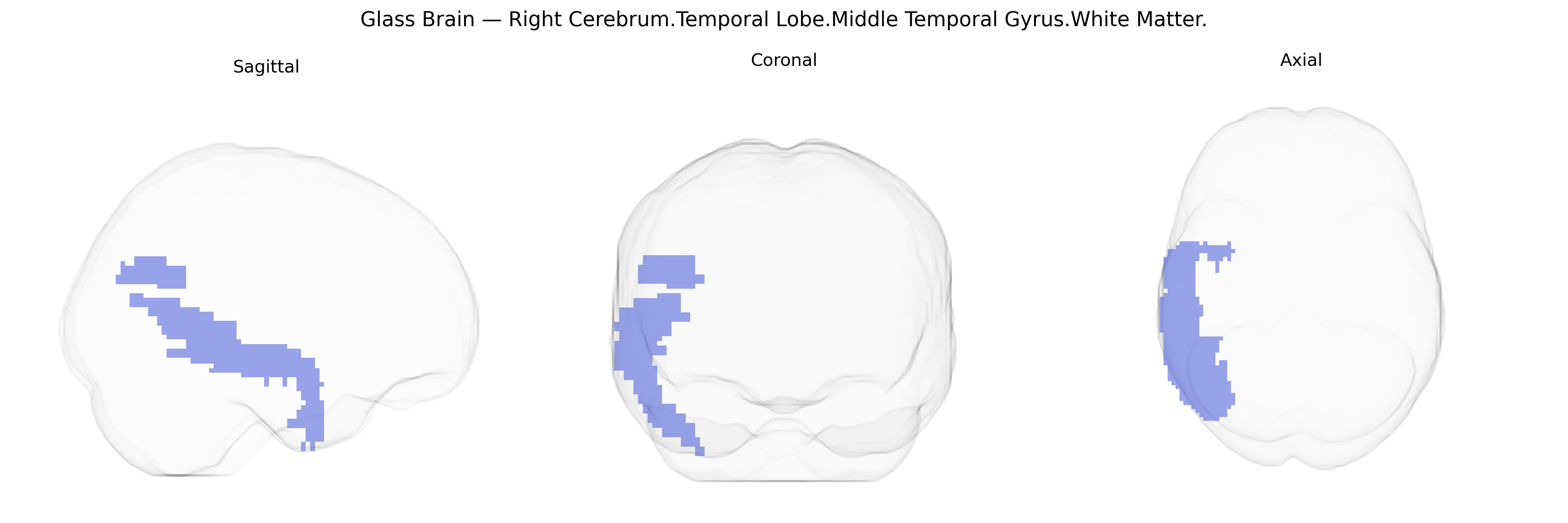 Triplanar Ghost Brain