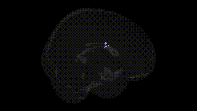 Full Brain Black