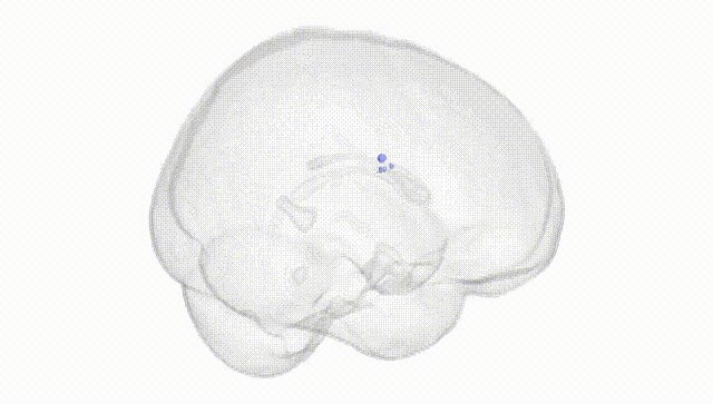Full Brain White