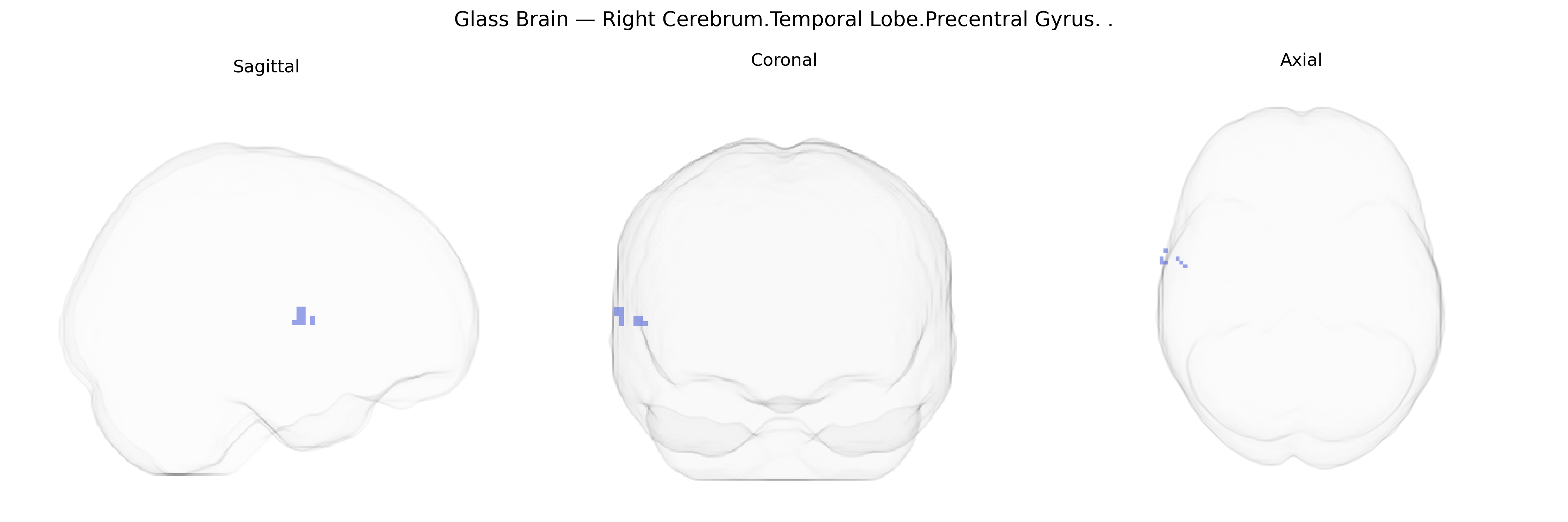 Triplanar Ghost Brain