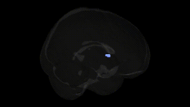 Full Brain Black