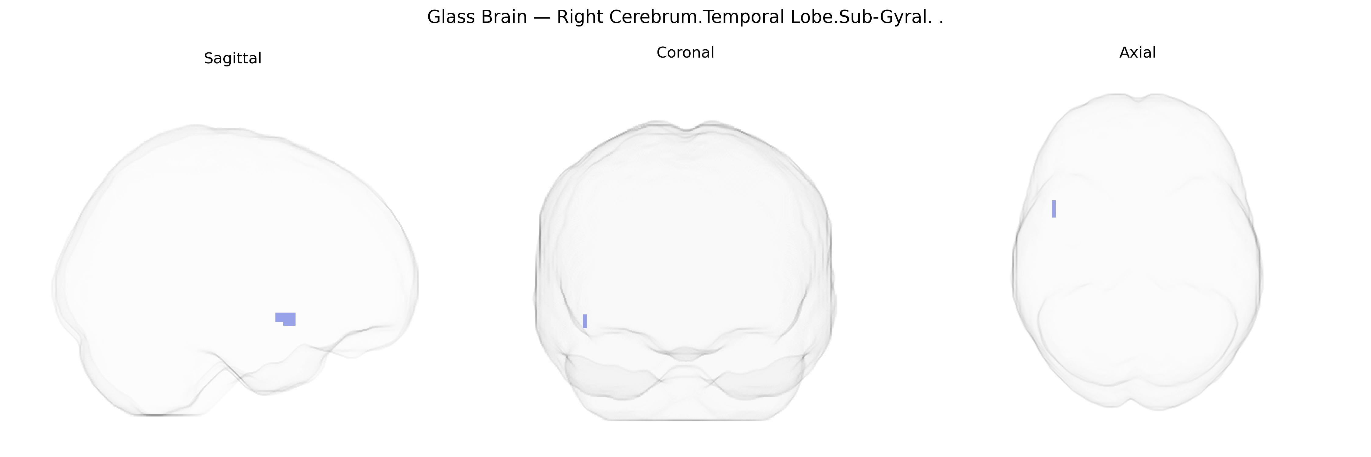 Triplanar Ghost Brain