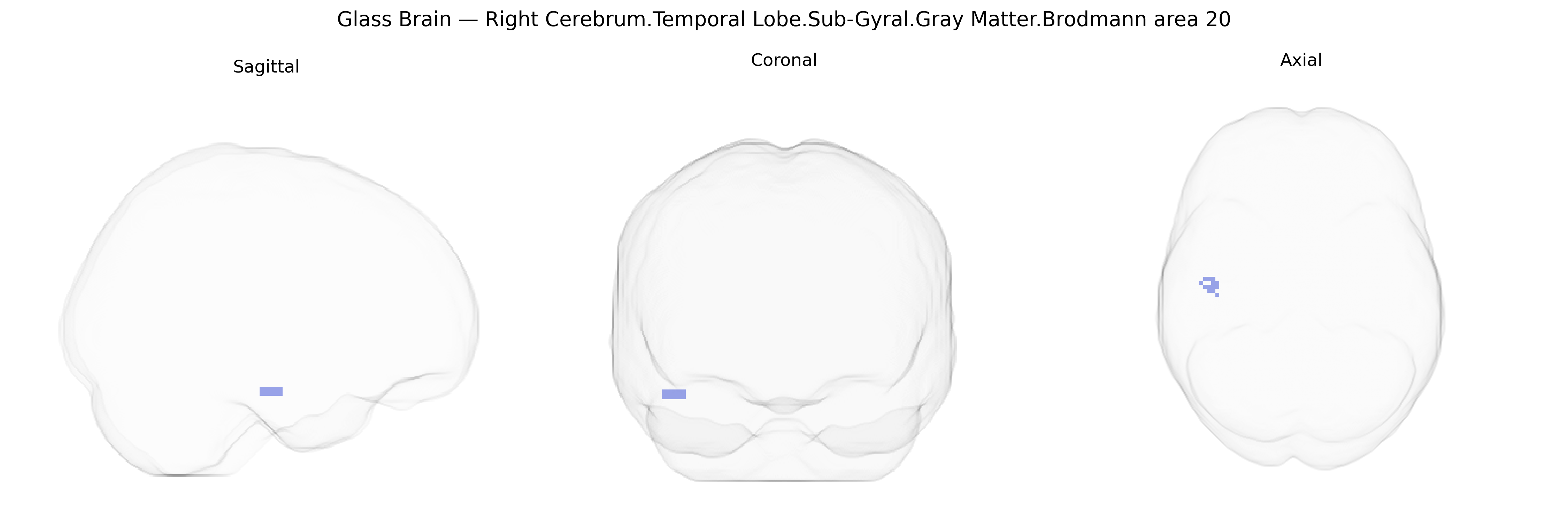 Triplanar Ghost Brain