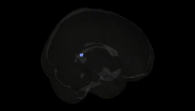 Full Brain Black
