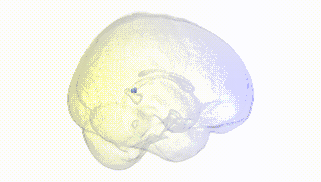 Full Brain White