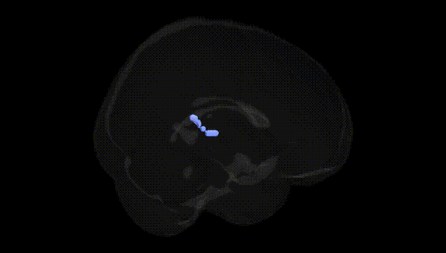 Full Brain Black