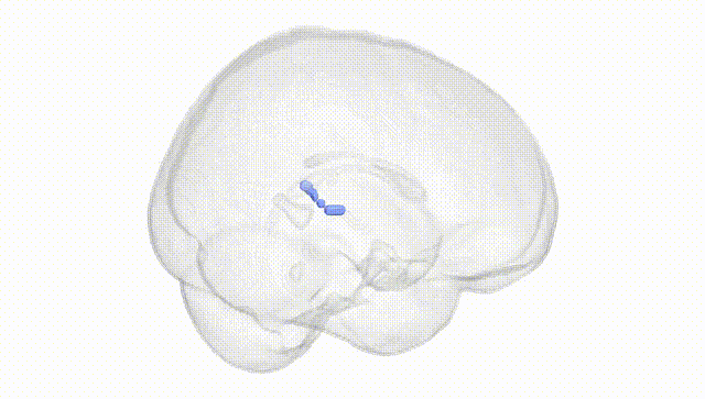 Full Brain White