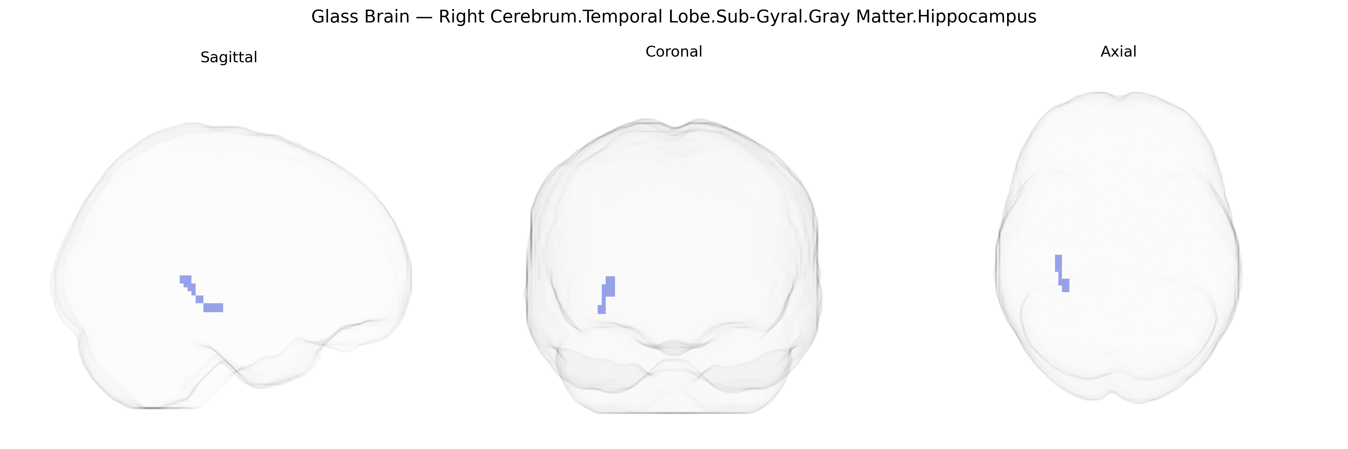 Triplanar Ghost Brain