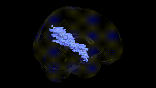 Full Brain Black