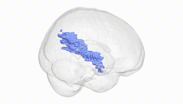 Full Brain White