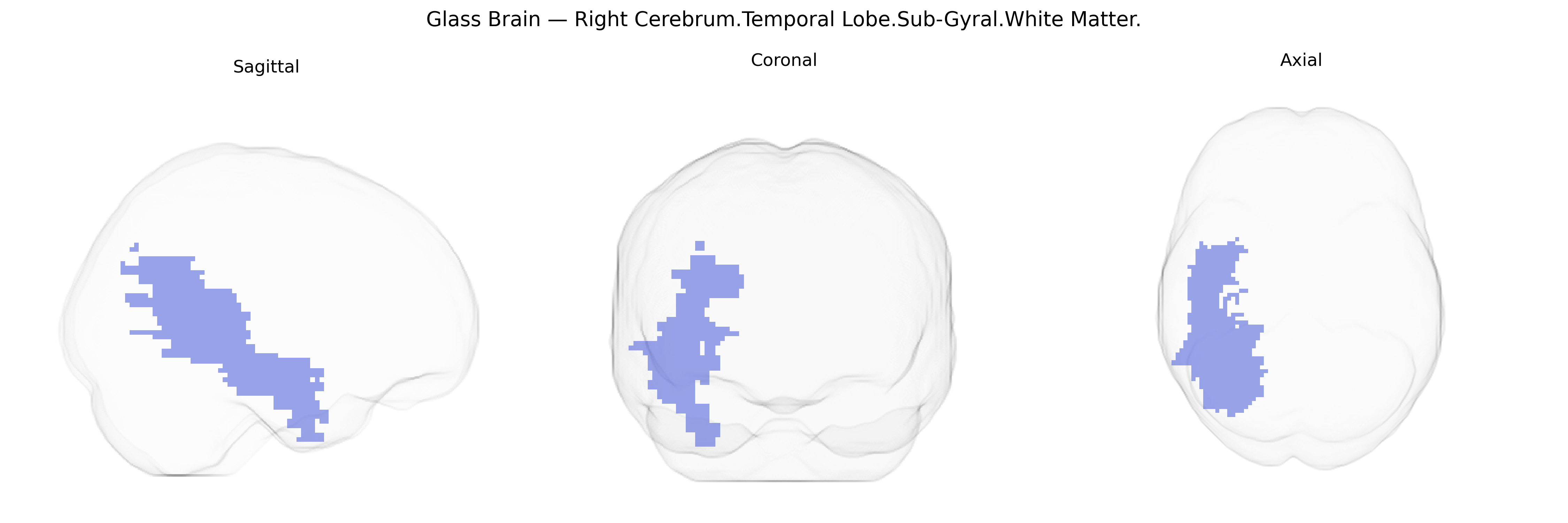 Triplanar Ghost Brain