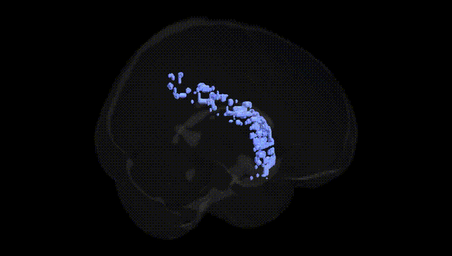 Full Brain Black
