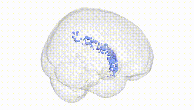 Full Brain White