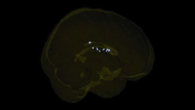 Full Brain Black
