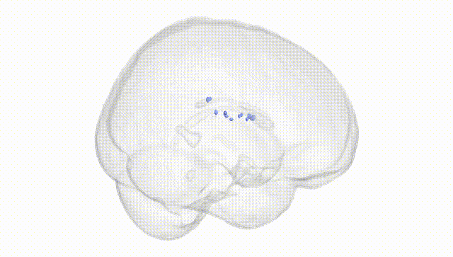 Full Brain White