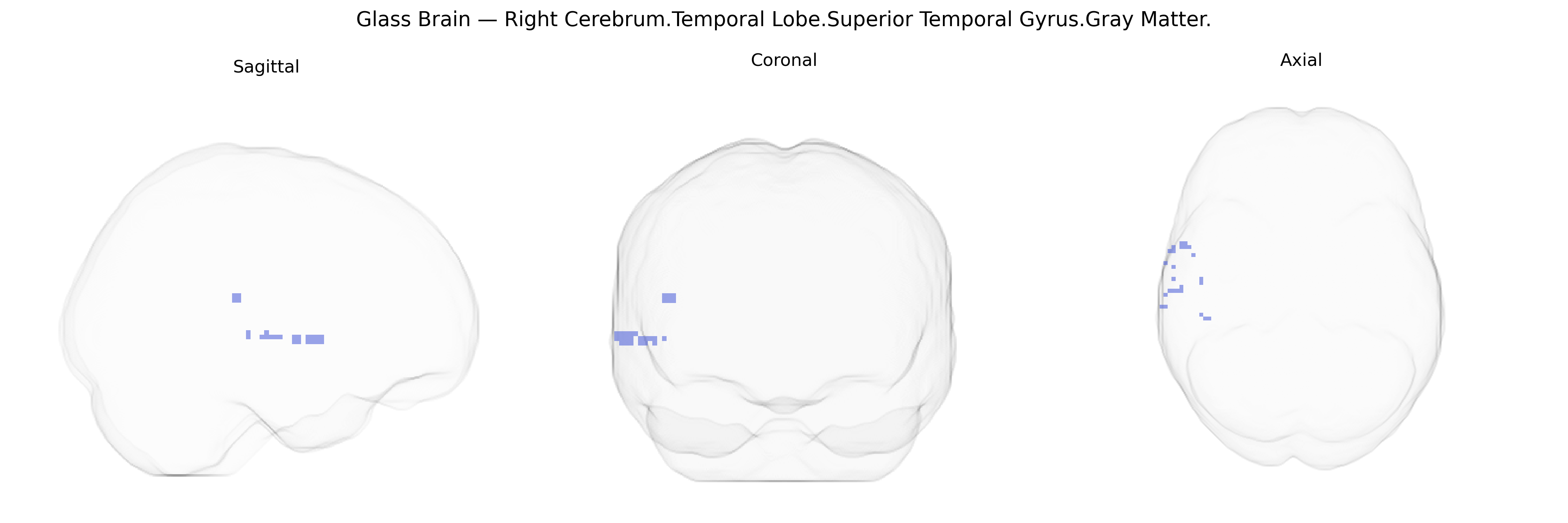 Triplanar Ghost Brain