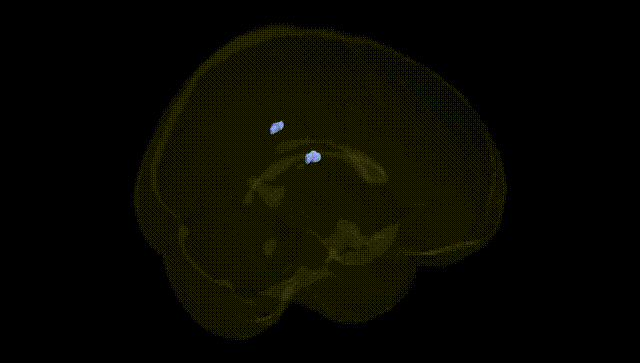 Full Brain Black