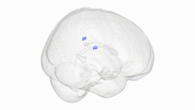 Full Brain White