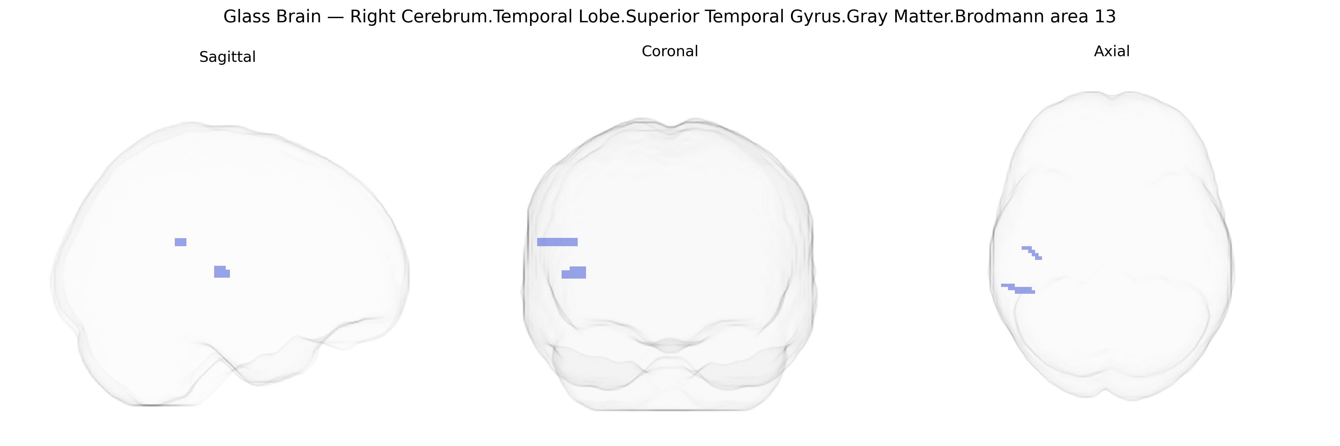 Triplanar Ghost Brain