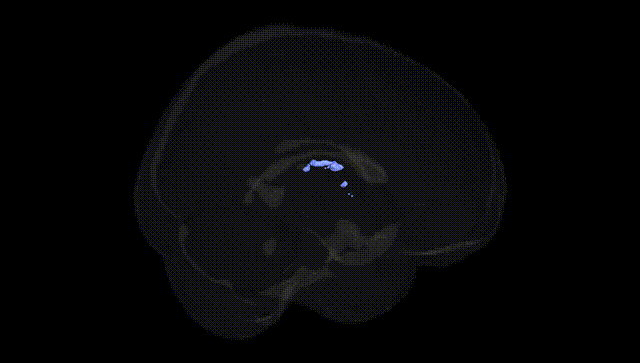 Full Brain Black
