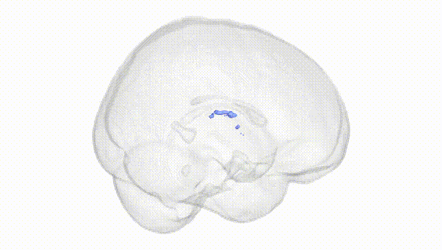 Full Brain White