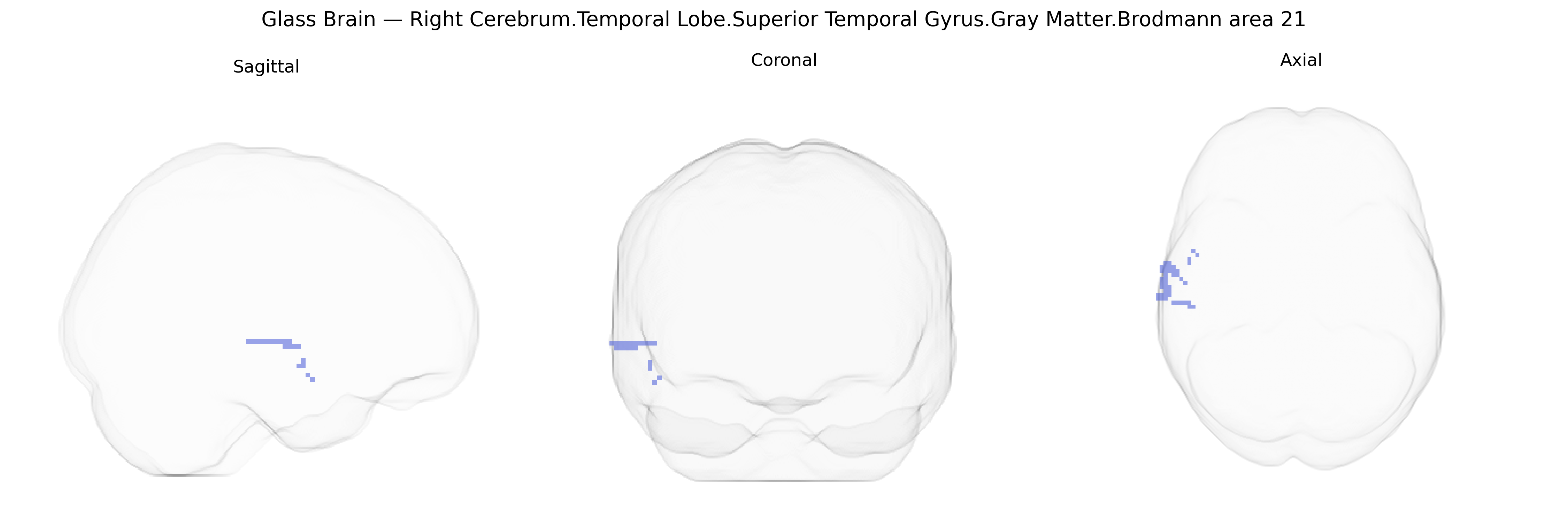 Triplanar Ghost Brain