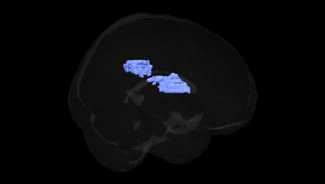 Full Brain Black