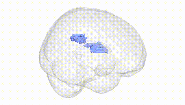Full Brain White