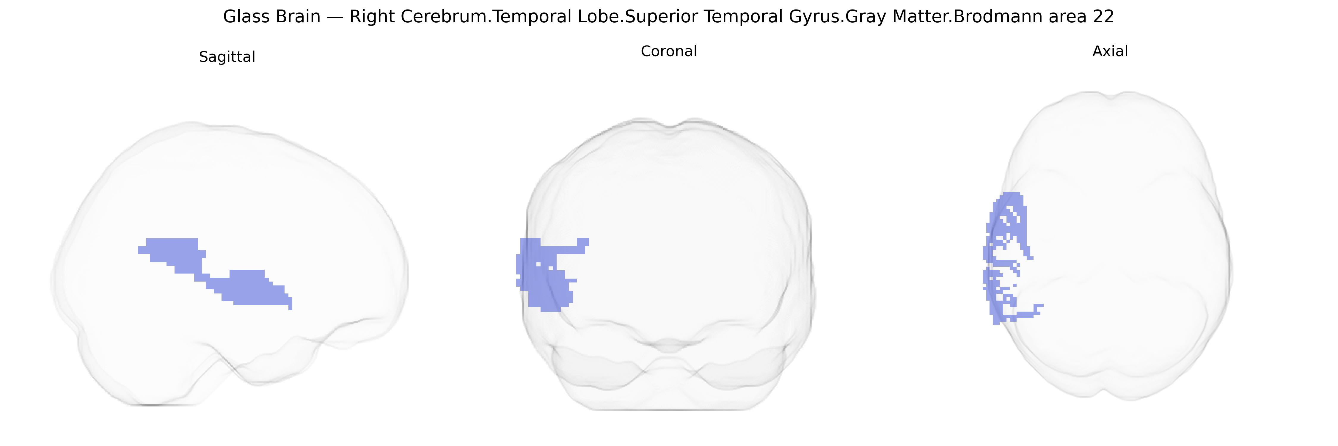 Triplanar Ghost Brain