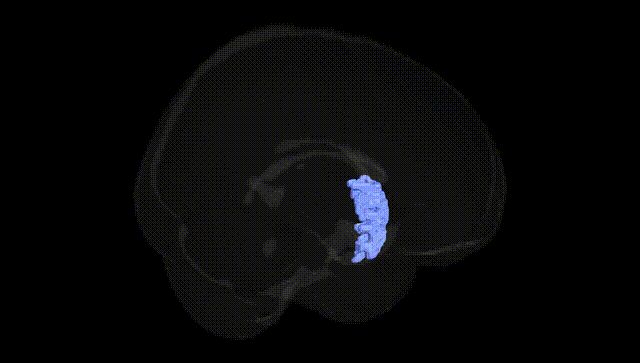 Full Brain Black