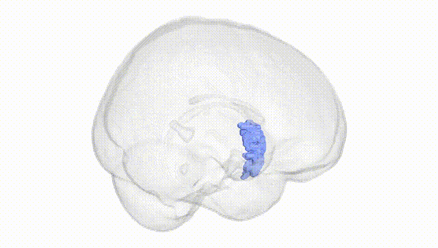 Full Brain White