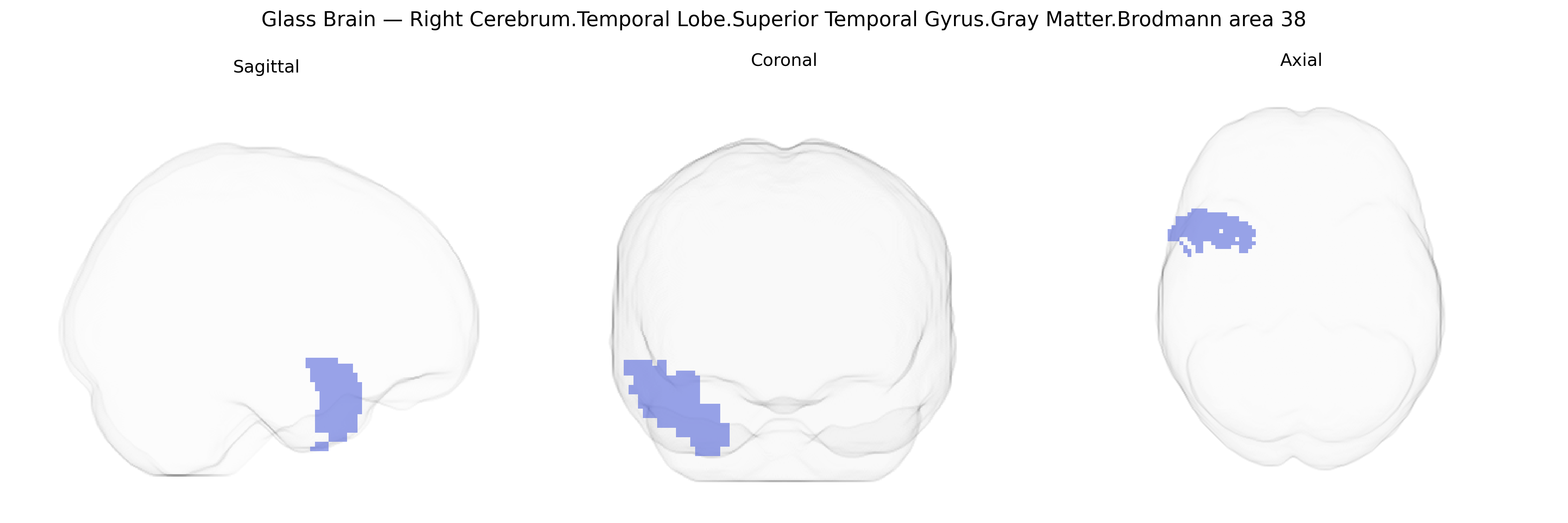 Triplanar Ghost Brain