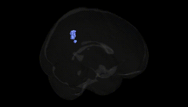 Full Brain Black