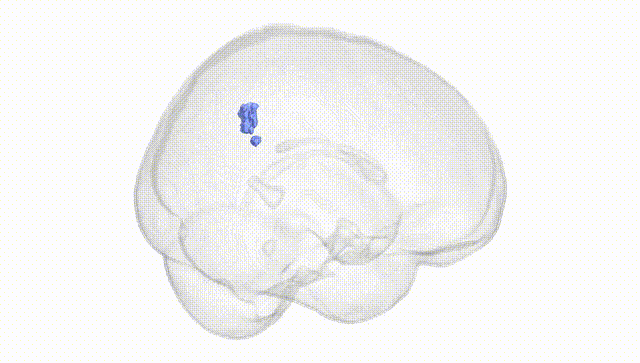Full Brain White