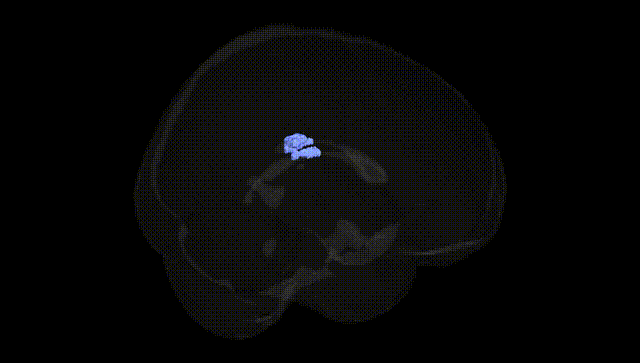 Full Brain Black
