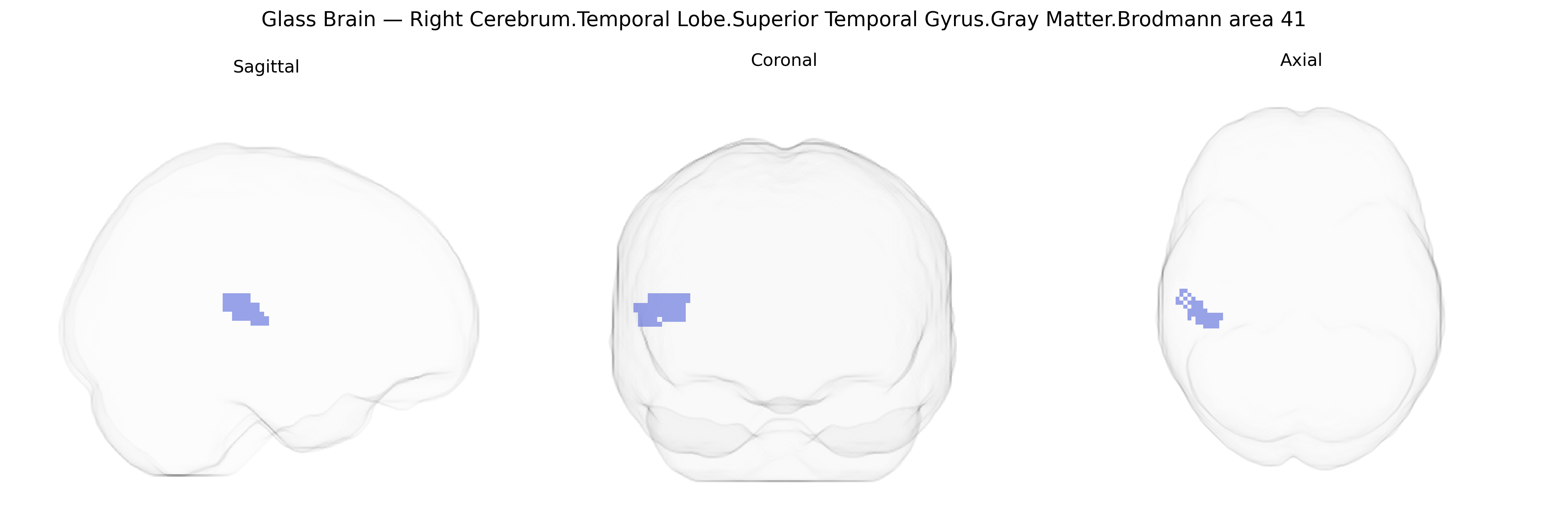 Triplanar Ghost Brain