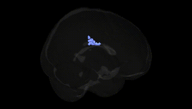Full Brain Black