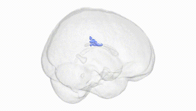 Full Brain White