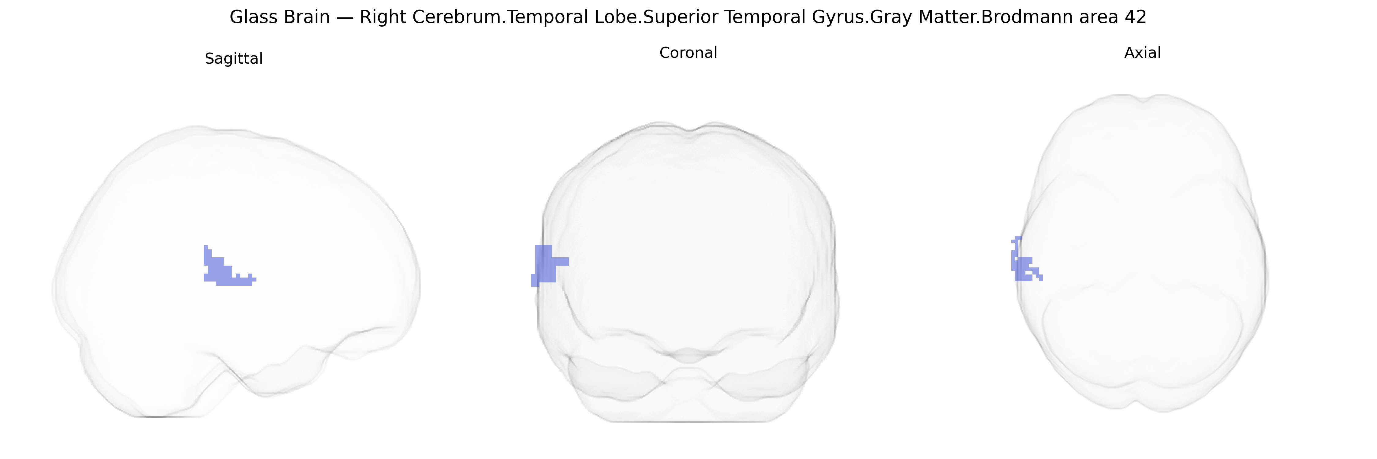 Triplanar Ghost Brain
