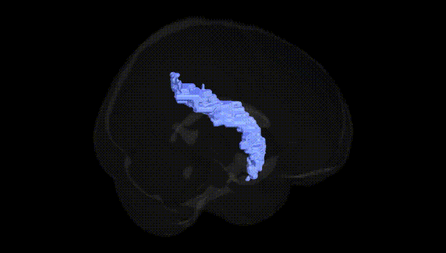 Full Brain Black